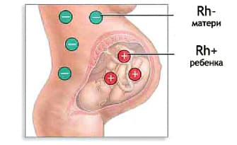 Вагітність з негативним резусом у жінки: чи можна завагітніти, як впливає на зачаття і виношування негативний фактор у мами
