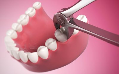 Болить ясна після видалення зуба: що робити в домашніх умовах