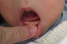 Ознаки прорізування зубів у немовлят 4 місяці: допомога малюкові