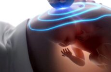3D-УЗД при вагітності (24 фото): на якому терміні краще робити УЗД плода, різниця результатів на 10-й та 20-й тижнях, відгуки