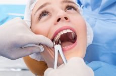 Як вирвати зуб у домашніх умовах: швидко і без болю
