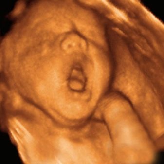 4D УЗД при вагітності (30 фото): що це таке, на якому терміні краще робити «живе» HD УЗД плода, шкода і користь від нього, відгуки