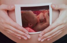 4D-УЗД при вагітності (30 фото): що це таке, на якому терміні краще робити «живе» HD-УЗД плода, шкода і користь від нього, відгуки