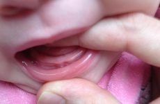Можуть різатися зуби в 3 місяці: симптоми і терміни прорізування