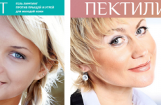 Пектилифт — унікальний російський препарат для боротьби з ознаками старіння