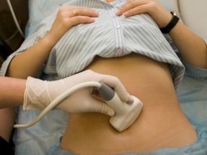 Відновлення після позаматкової вагітності і видалення труби: бувають виділення після лікування з операцією і чи можна завагітніти якщо видалили трубу