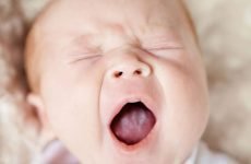 Молочниця у новонароджених в роті: причини, методи діагностики та лікування