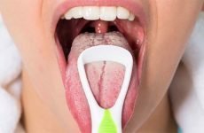 Протигрибкові препарати для порожнини рота: найефективніші засоби