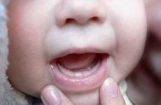 Коли ріжуться перші зуби у немовлят: терміни і симптоми
