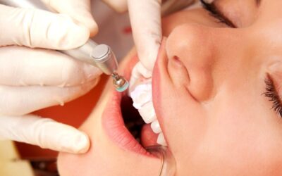 Що і за скільки можна їсти після чищення зубів: поради стоматологів