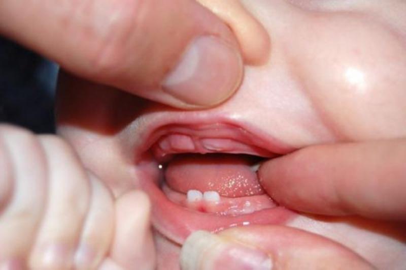Скільки повинно бути зубів у дитини у 4 роки: кількість і терміни прорізування