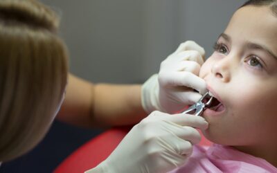 Видалення молочних зубів у дітей: показання та протипоказання до проведення процедури