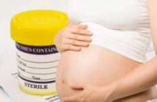 При вагітності лейкоцити в сечі (34 фото): підвищений цукор при аналізі і еритроцитів, слиз і кишкова паличка, причини відхилень і норма