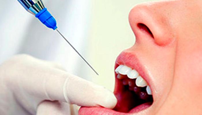 Скільки живе зуб без нерва: відгуки стоматологів