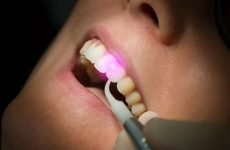 Лікування зубів лазером: методика проведення, плюси і мінуси процедури
