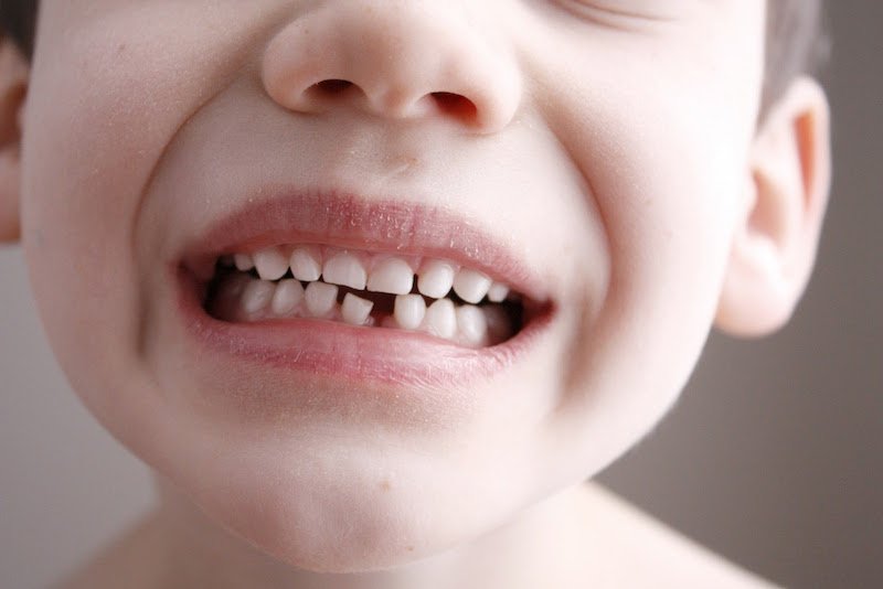 Скільки повинно бути зубів у дитини у 4 роки: кількість і терміни прорізування