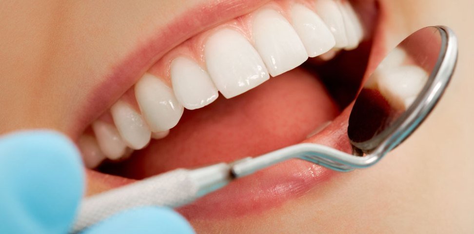 Що таке полірування зубів: особливості проведення процедури