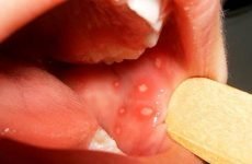 Захворювання порожнини рота: причини виникнення, методи діагностики та лікування