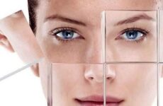 Види найефективніших процедур для вирівнювання кольору обличчя будинку або в кабінеті косметолога