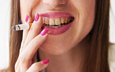 Вплив куріння на зуби: можливі наслідки для здоров’я порожнини рота