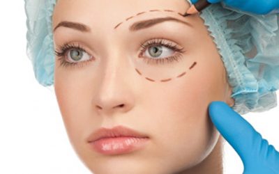 Підтяжка обличчя хірургічним шляхом — види, етапи операції, реабілітація