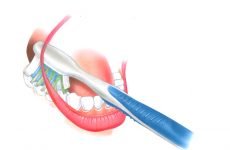 Зубна нитка: різновиди, переваги і недоліки