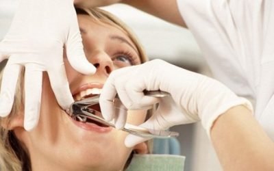 Боляче видаляти зуб: особливості процедури