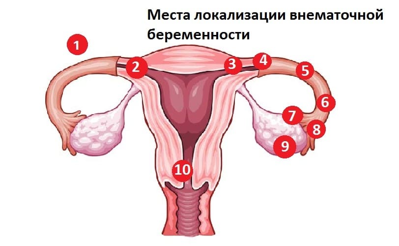 Базальна температура при позаматкової вагітності на ранніх термінах: чи є відмінності між простою вагітністю, і яка вона повинна бути?