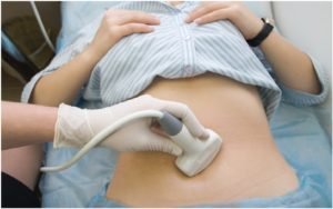 Лапароскопія при позаматкової вагітності: найбільш ефективний і щадний спосіб видалення плідного яйця із збереженням маткової труби