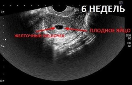 ХГЛ (52 фото): норма показників при вагітності по тижнях і днях від зачаття таблиці, як здати кров на аналіз і що це таке