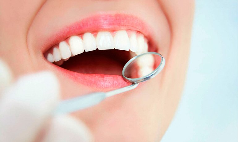 Імплантація зубів: особливості, плюси і мінуси
