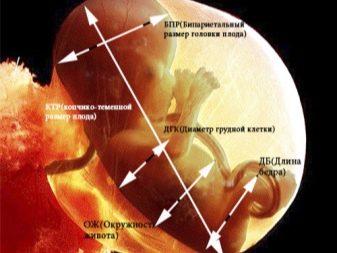 УЗД на ранніх термінах вагітності (22 фото): як часто можна робити, що перший покаже і шкідливо чи ні