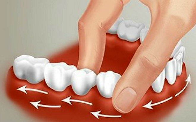 Як зміцнити хитаючийся зуб в домашніх умовах: причини і методи лікування
