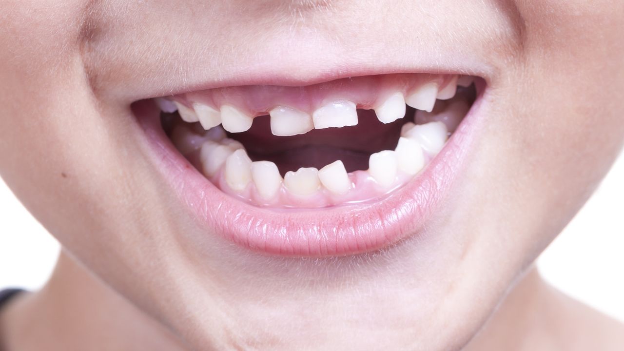 Скільки молочних зубів має бути у дітей: кількість і терміни появи