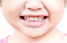 Будова молочних зубів у дітей – важливі особливості