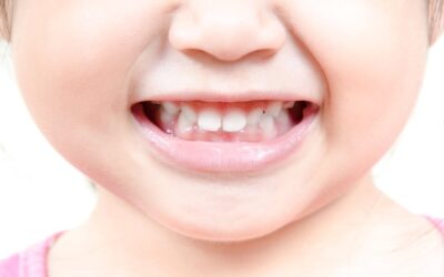 Будова молочних зубів у дітей – важливі особливості