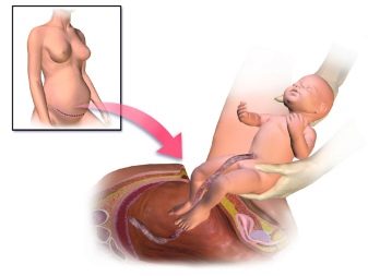 На якому терміні роблять 3 УЗД при вагітності (23 фото): коли роблять третій скринінг, норми показників на 34 38 тижнях