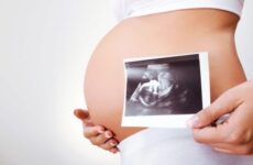 На якому терміні роблять 3 УЗД при вагітності (23 фото): коли роблять третій скринінг, норми показників на 34-38 тижнях