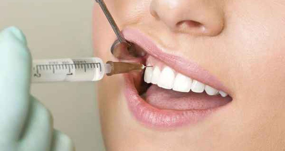 Видалення зубів під загальним наркозом: відгуки пацієнтів