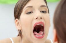 Чому свербить небо у роті: причини, симптоми і методи лікування