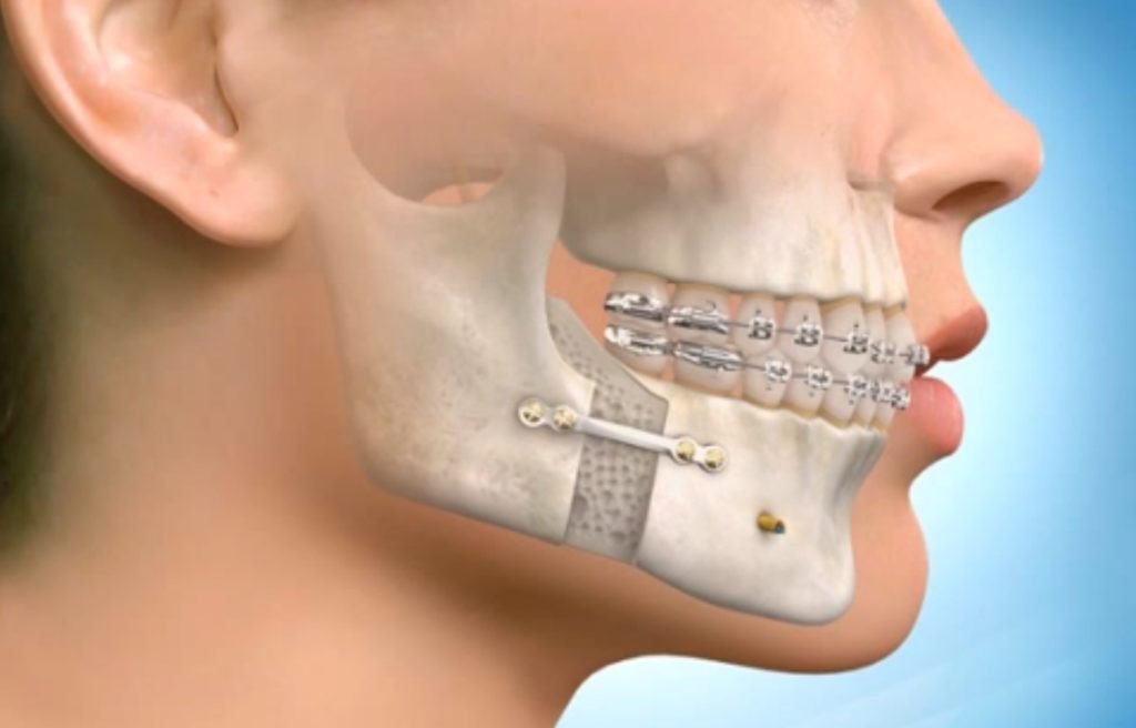 Показання до видалення зуба   коли виникає необхідність видалення