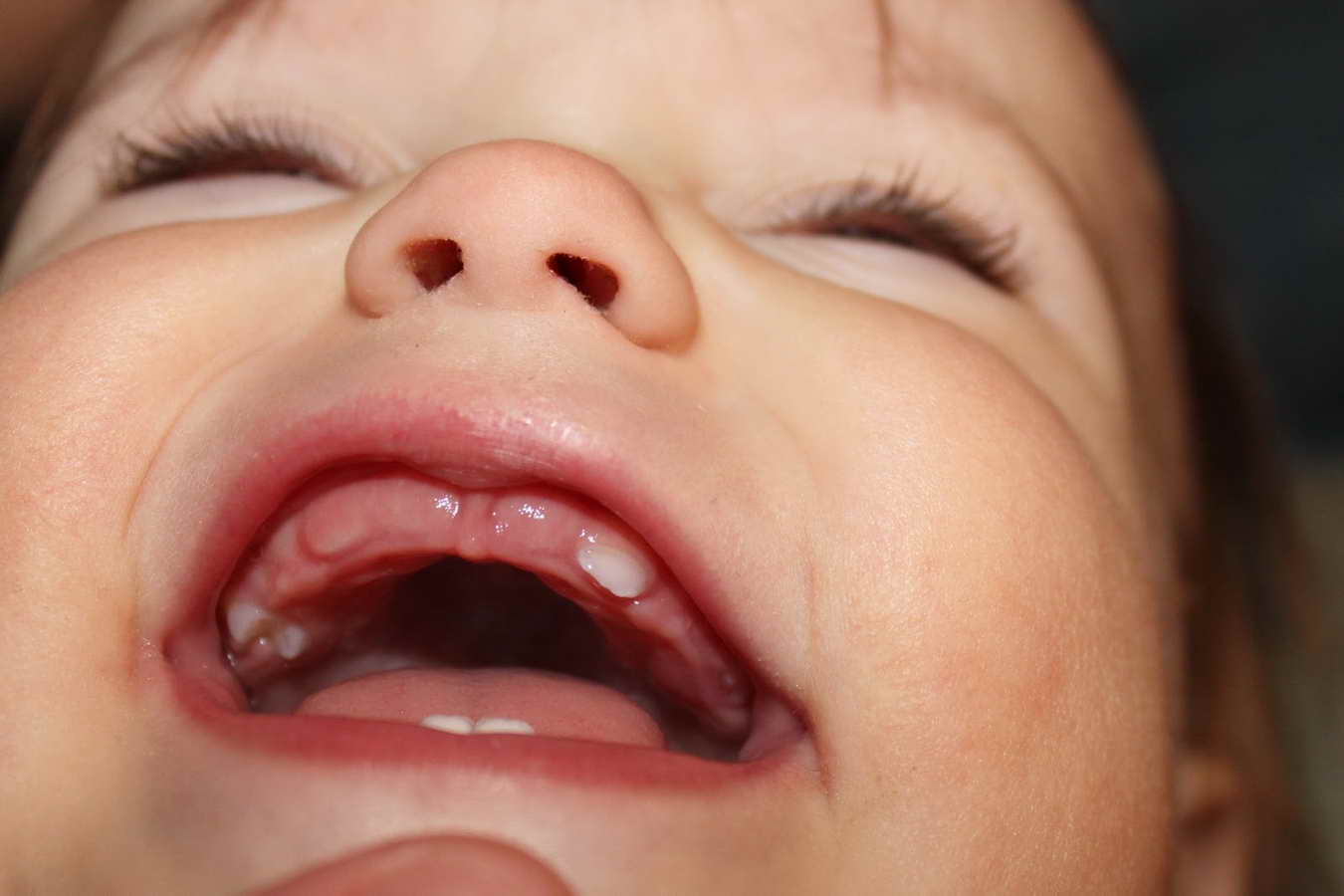 Скільки повинно бути зубів у дитини в 3 роки: кількість і терміни прорізування