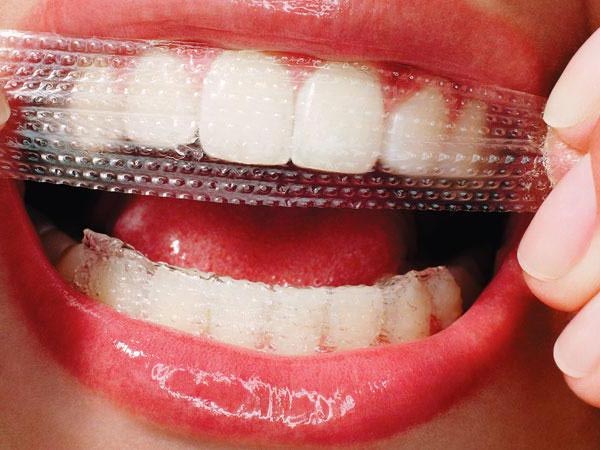Що таке відбілюючі смужки для зубів: огляд та відгуки покупців