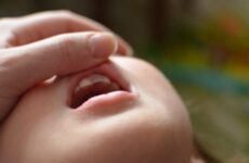 Після удару потемнів молочний зуб у дитини: причини та відгуки