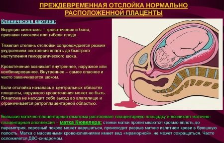 Підвищений білок у сечі при вагітності   що це значить: причини підвищення, сліди на пізніх термінах, добова норма