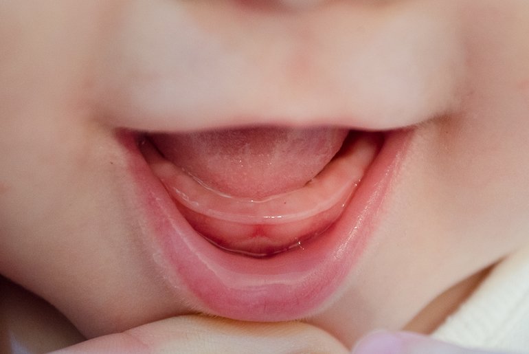 У дитини 10 місяців немає зубів: чому і що робити?