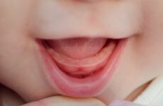 Народні засоби при прорізуванні зубів у немовлят: як допомогти дитині?