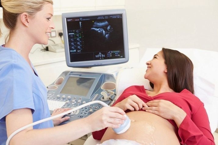 УЗД на 33 тижні вагітності (12 фото): норма показників при аналізі і їх розшифровка на 32 тижні, таблиця розмірів плода
