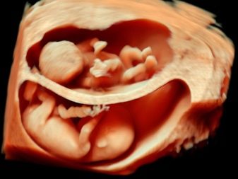 УЗД на 8 тижні вагітності (32 фото): розміри плоду на 7 акушерської тижня, огляд малого тазу з докладним описом