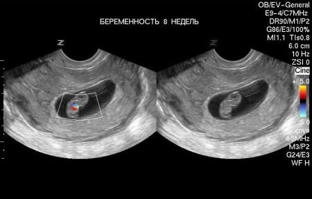 УЗД на 8 тижні вагітності (32 фото): розміри плоду на 7 акушерської тижня, огляд малого тазу з докладним описом